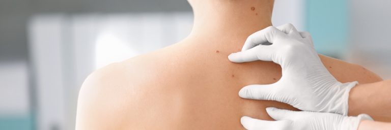 Medimust le logiciel médical avec module Dermatologie